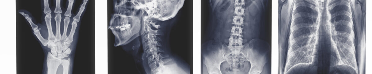 Medical-Xray