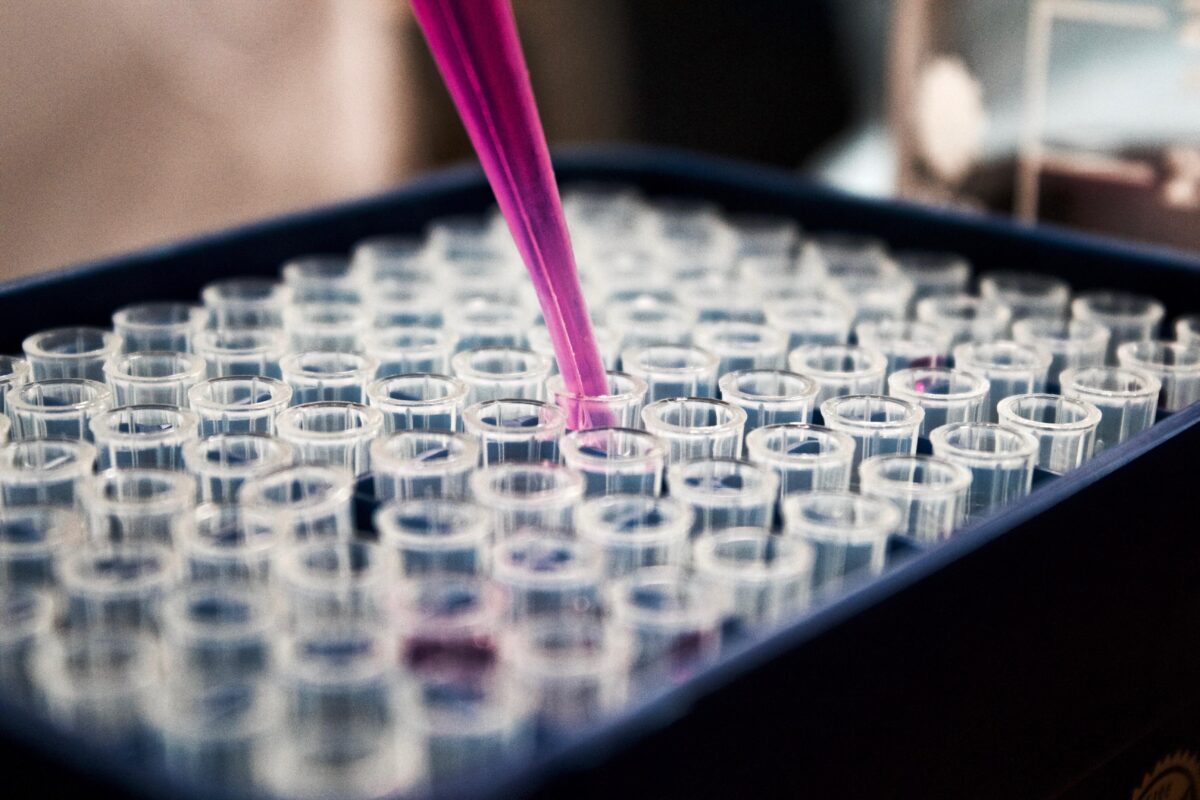 Lab tube testing