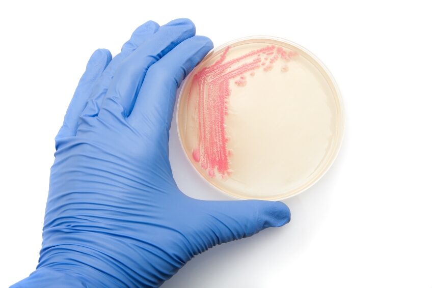 Environmental Microbiology (EM) plates