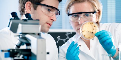 Bacteria count on agar plate